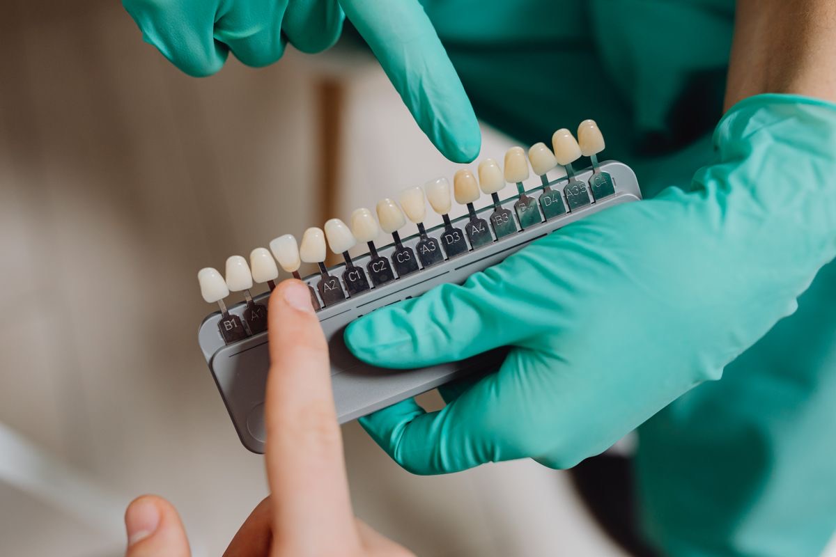 Dentist using a dental shade guide to plan veneers or crowns