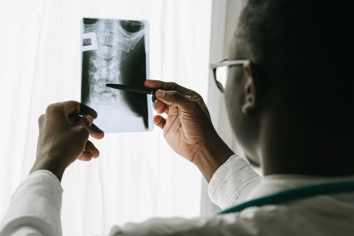 Dentist examining a dental x-ray for digital diagnosis