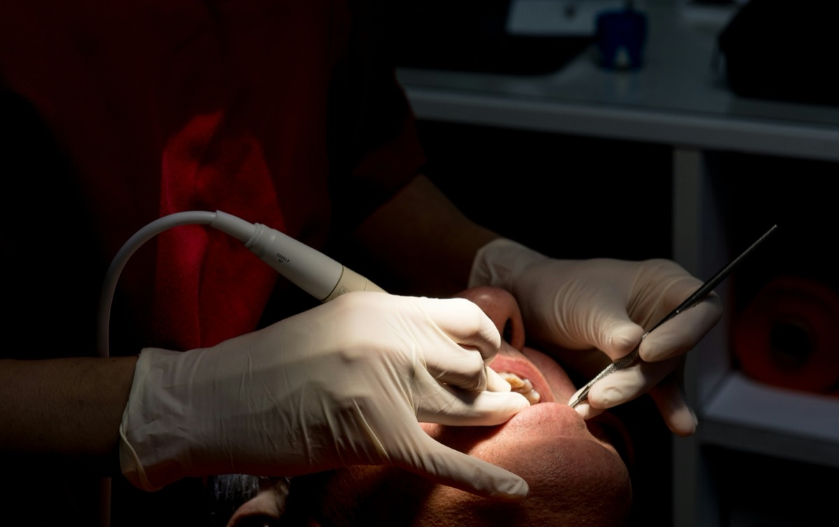 Professional dental cleaning for ongoing gum health maintenance