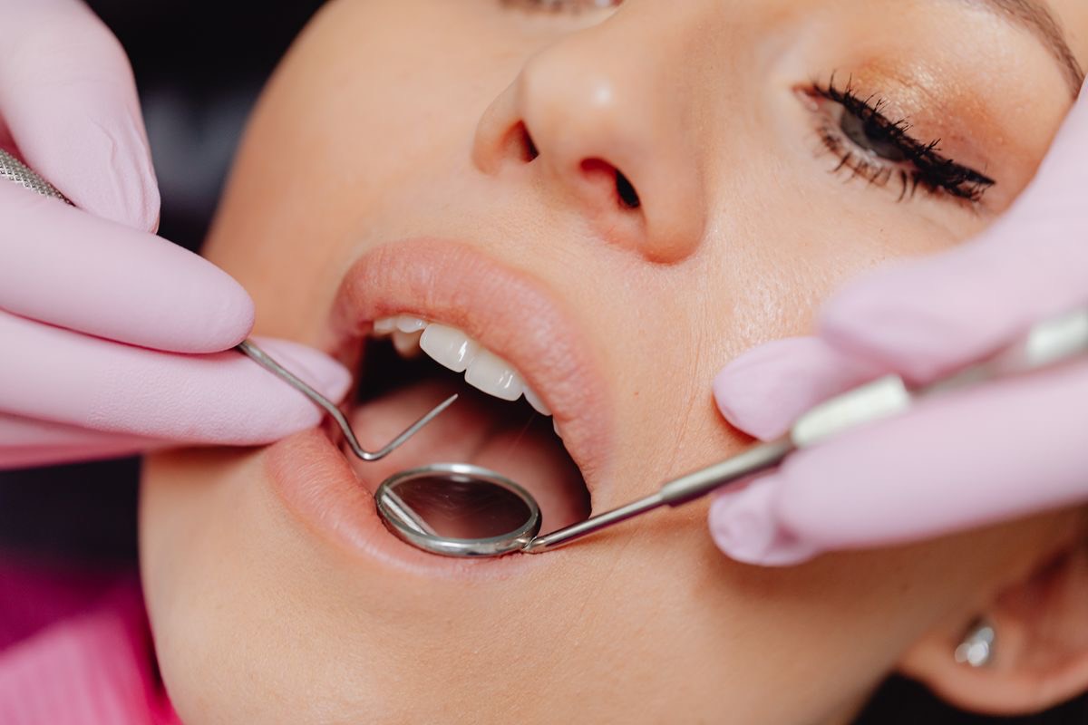 Close-up dental exam of teeth and gums during assessment