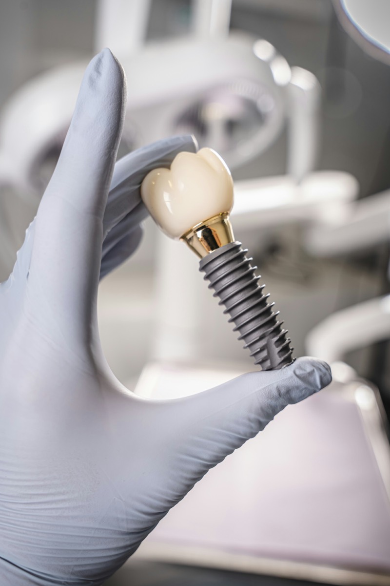 Dental implant and crown held by a dentist in gloves