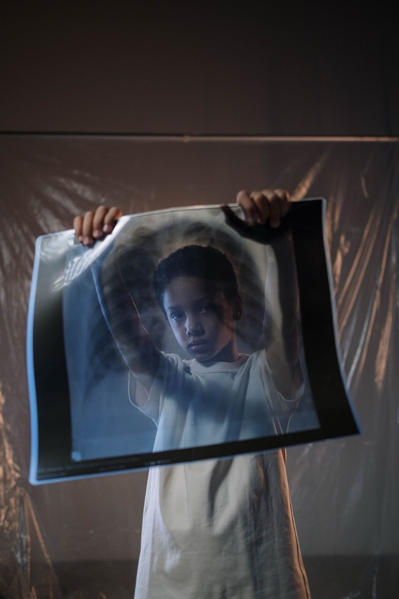 Child holding a dental x-ray during an early dental visit