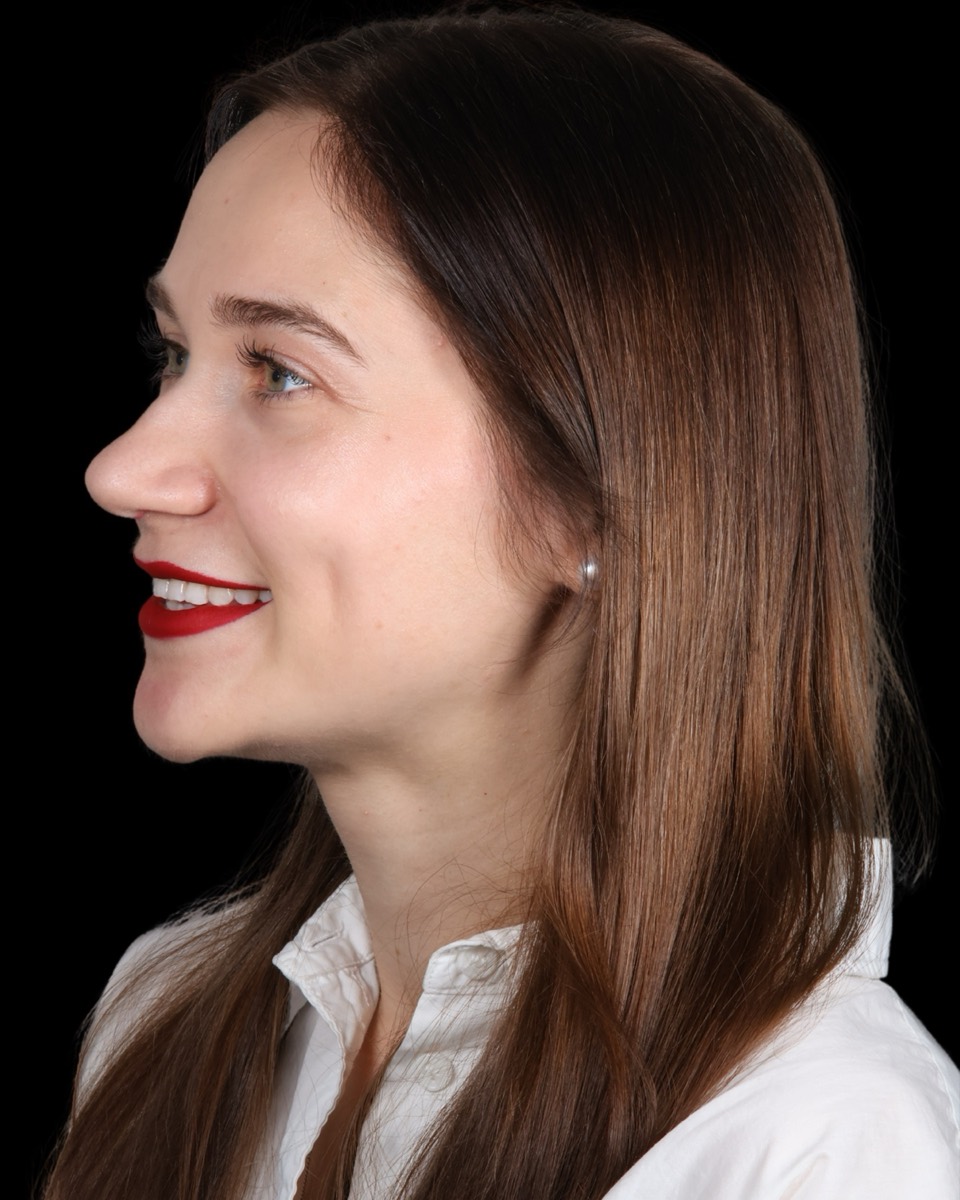 Smile Case 1 image 6