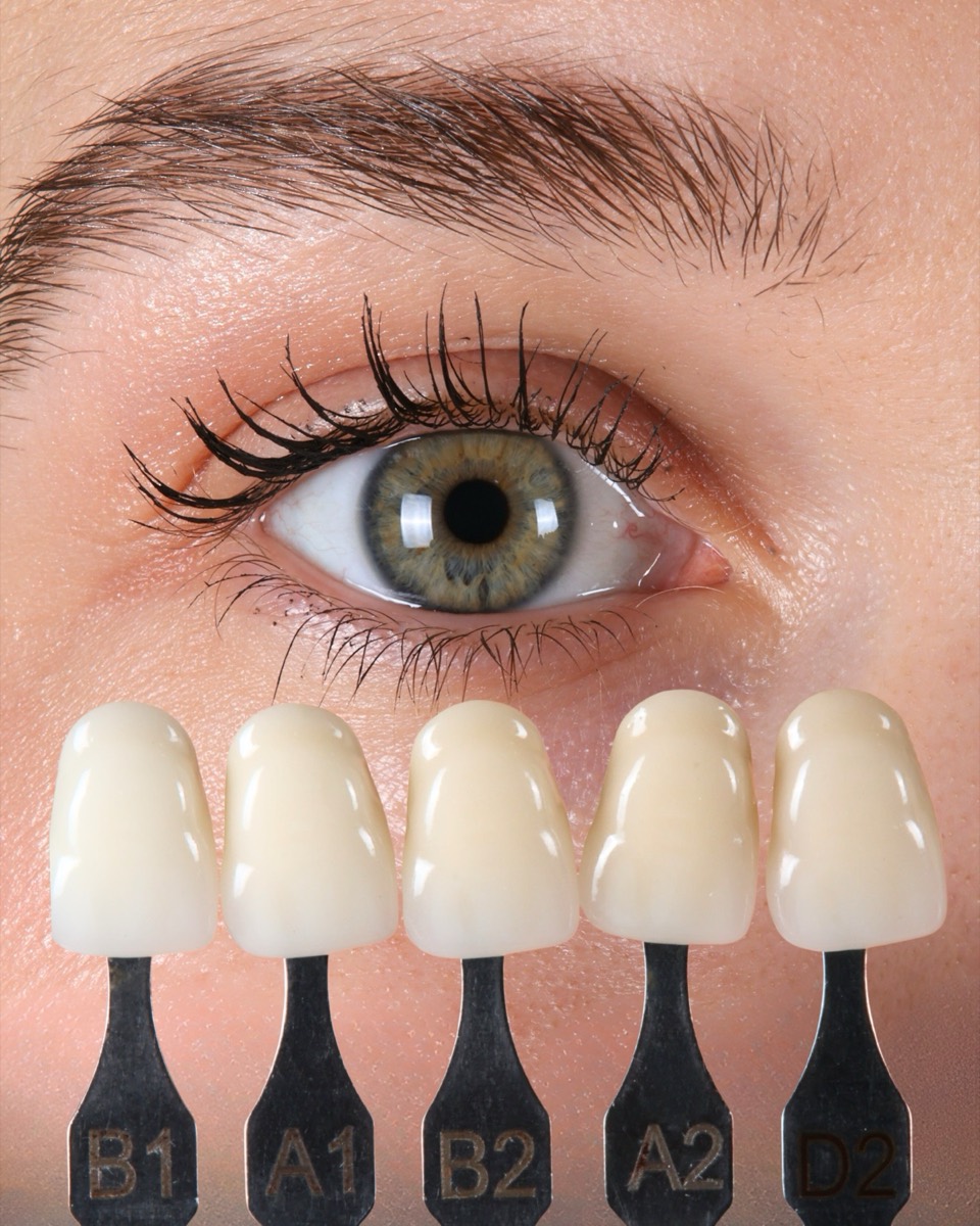 Smile Case 1 image 7