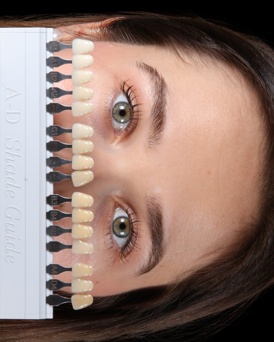 Smile Case 1 image 8