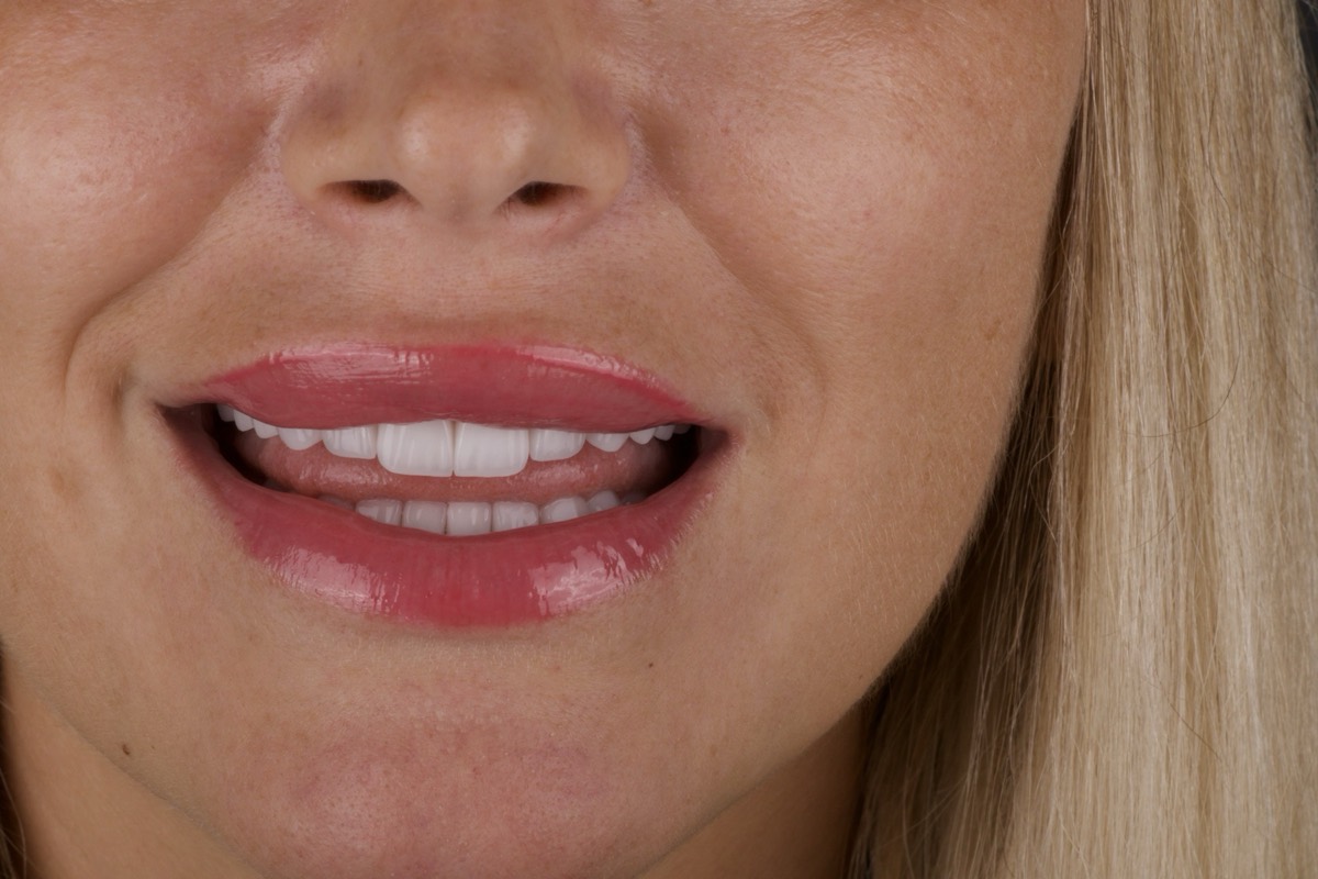Smile Case 10 image 6
