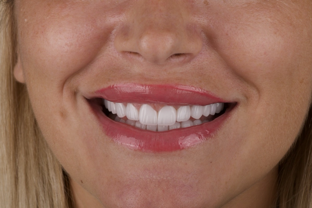 Smile Case 10 image 7