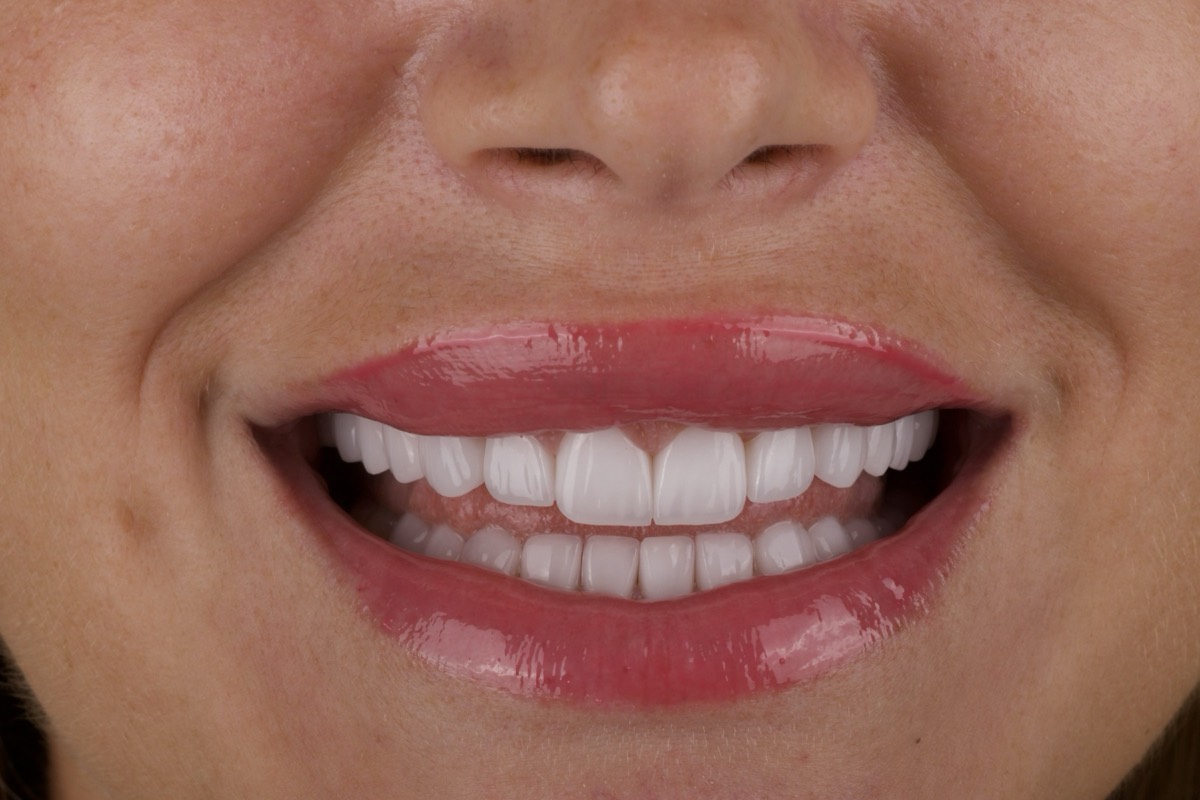 Smile Case 10 image 9
