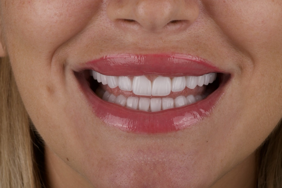 Smile Case 10 image 10