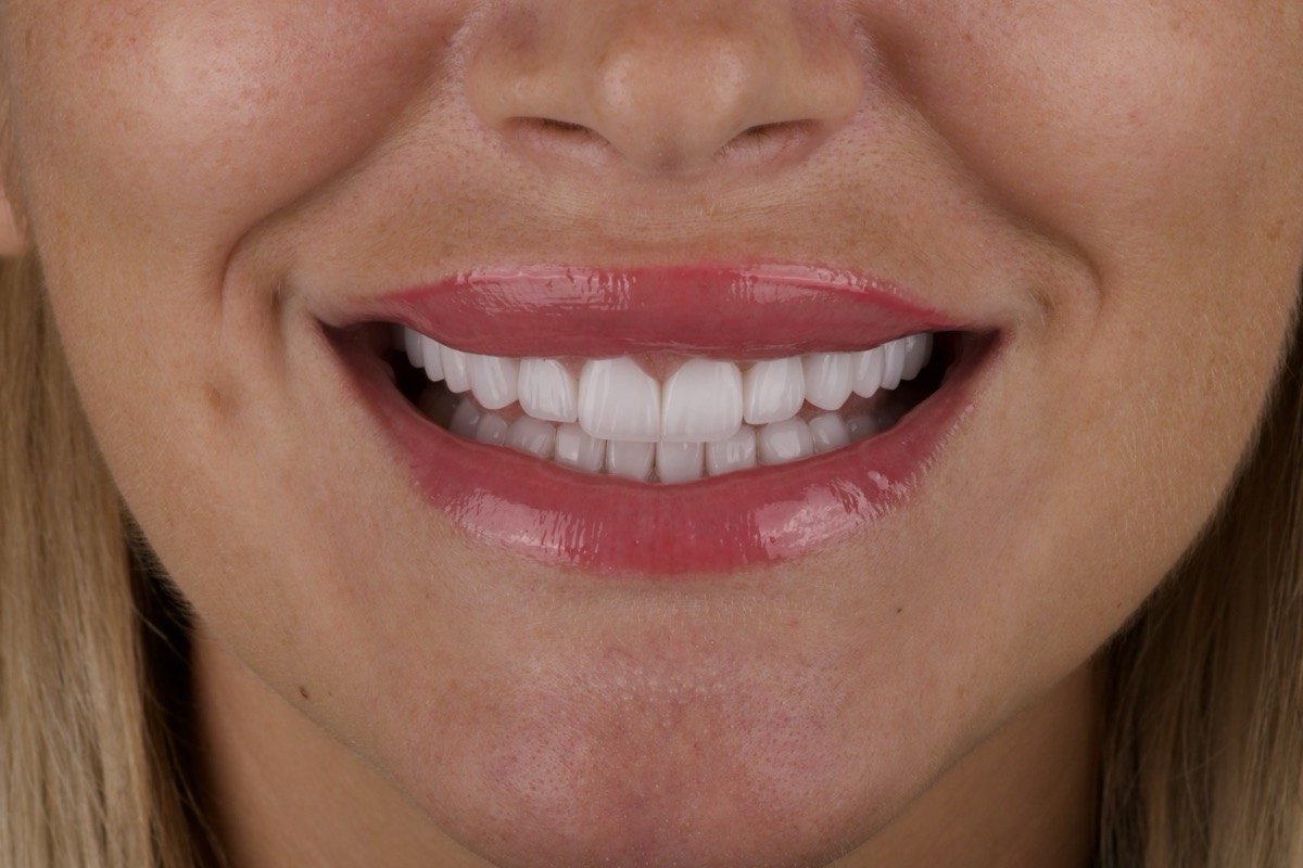Smile Case 10 image 11
