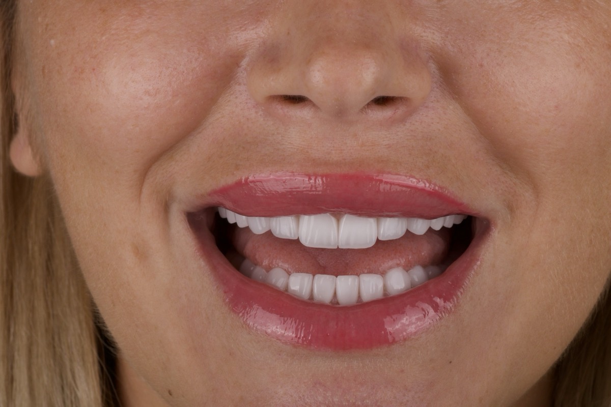 Smile Case 10 image 12