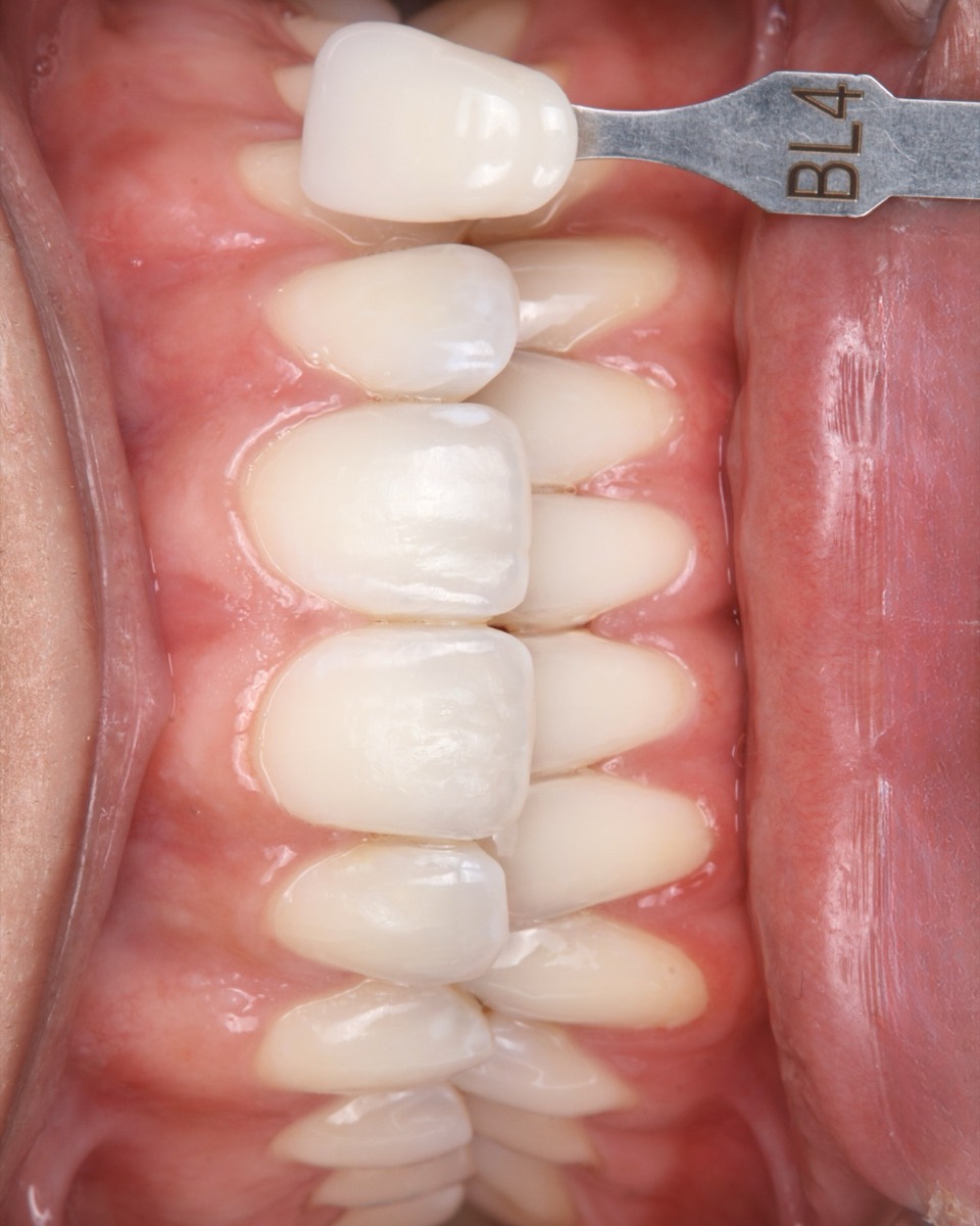 Smile Case 2 cover