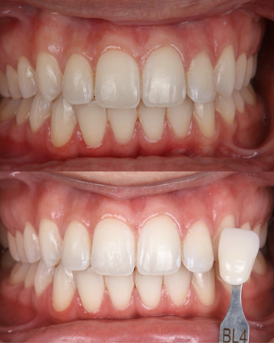 Smile Case 2 image 3