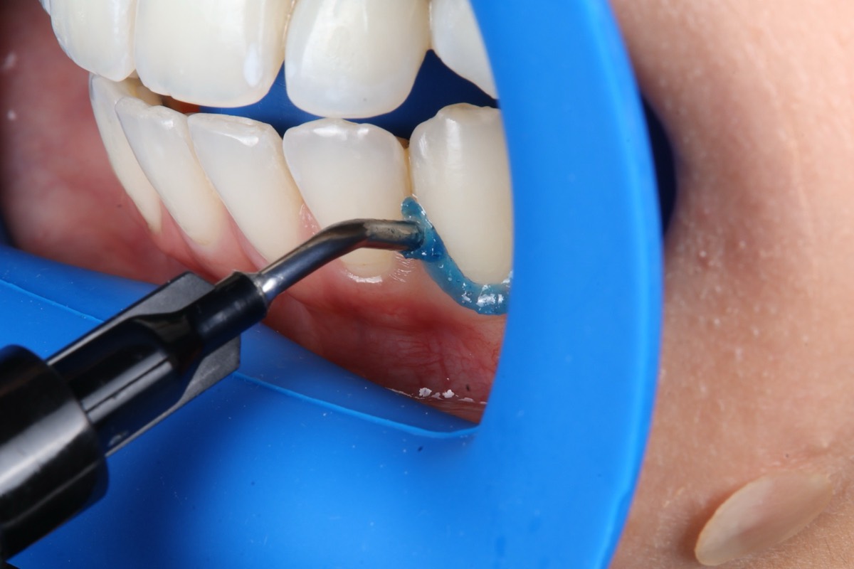 Smile Case 2 image 7