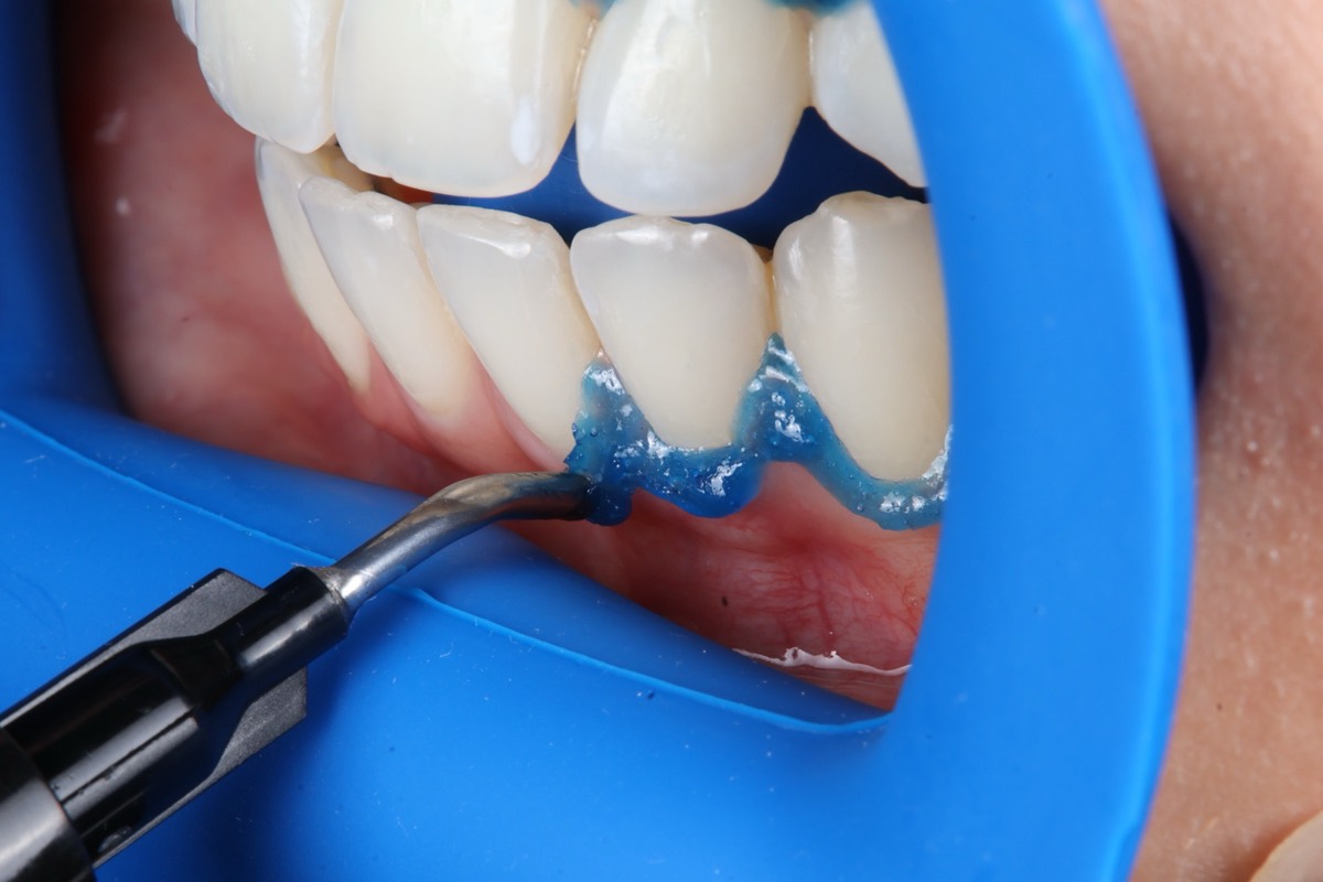 Smile Case 2 image 8