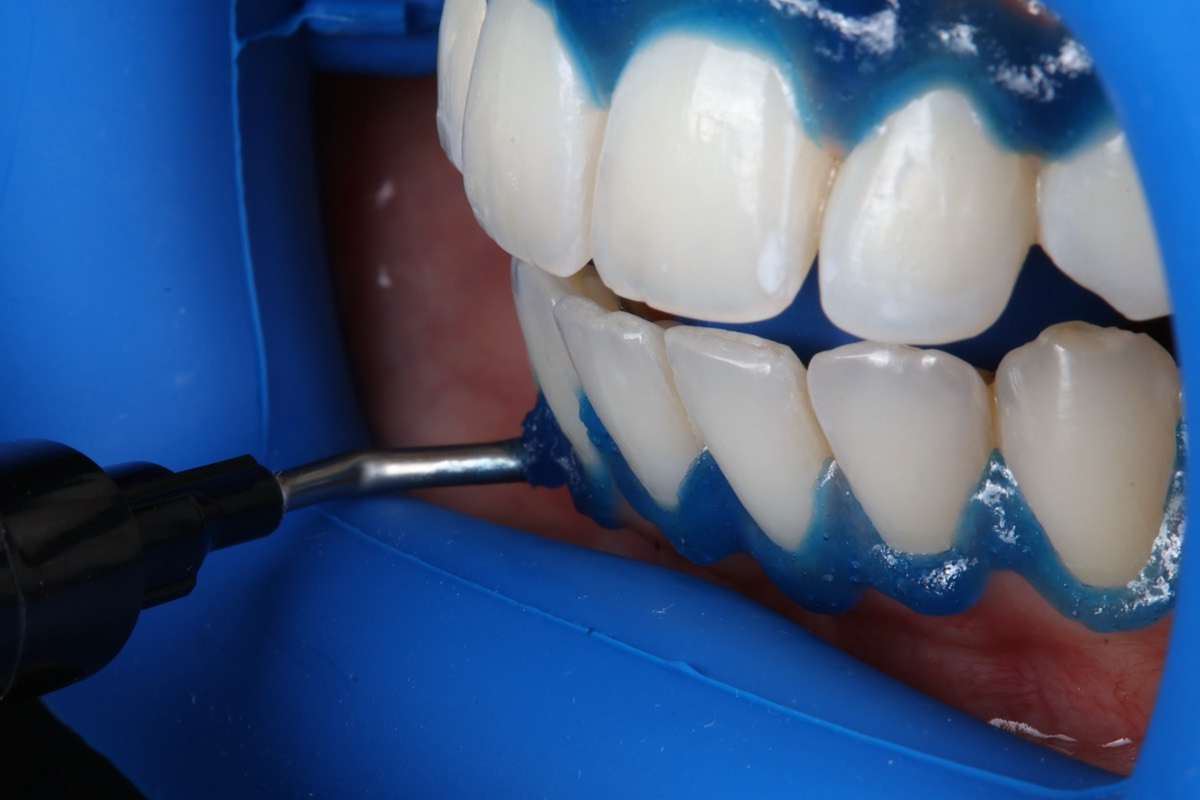 Smile Case 2 image 9