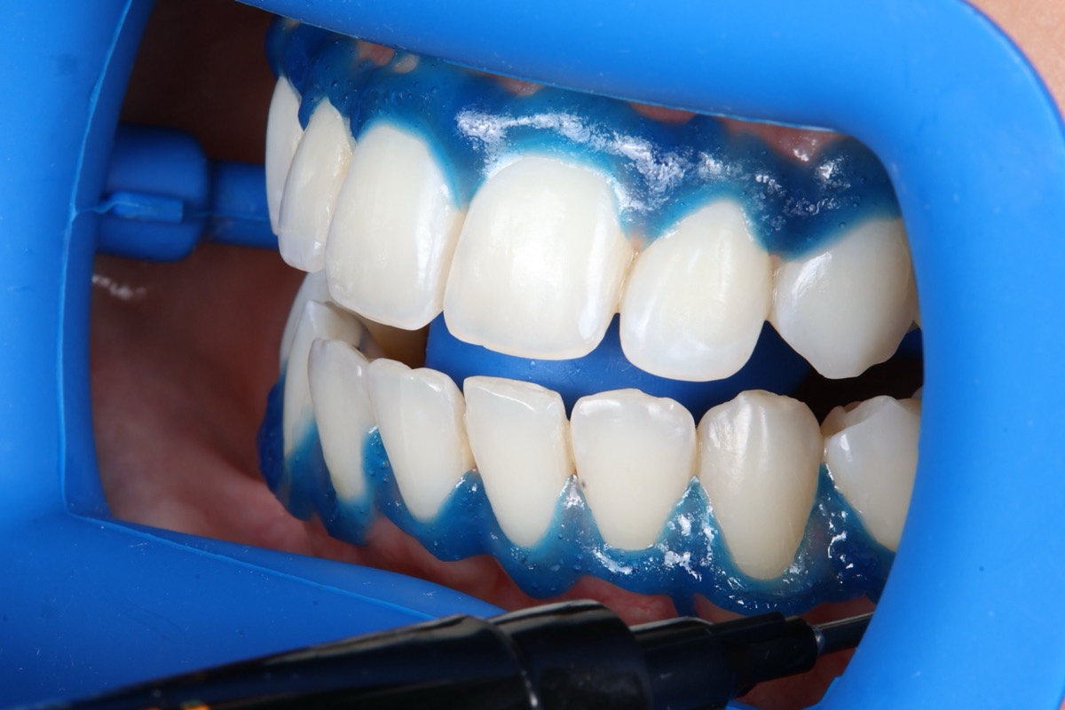 Smile Case 2 image 10