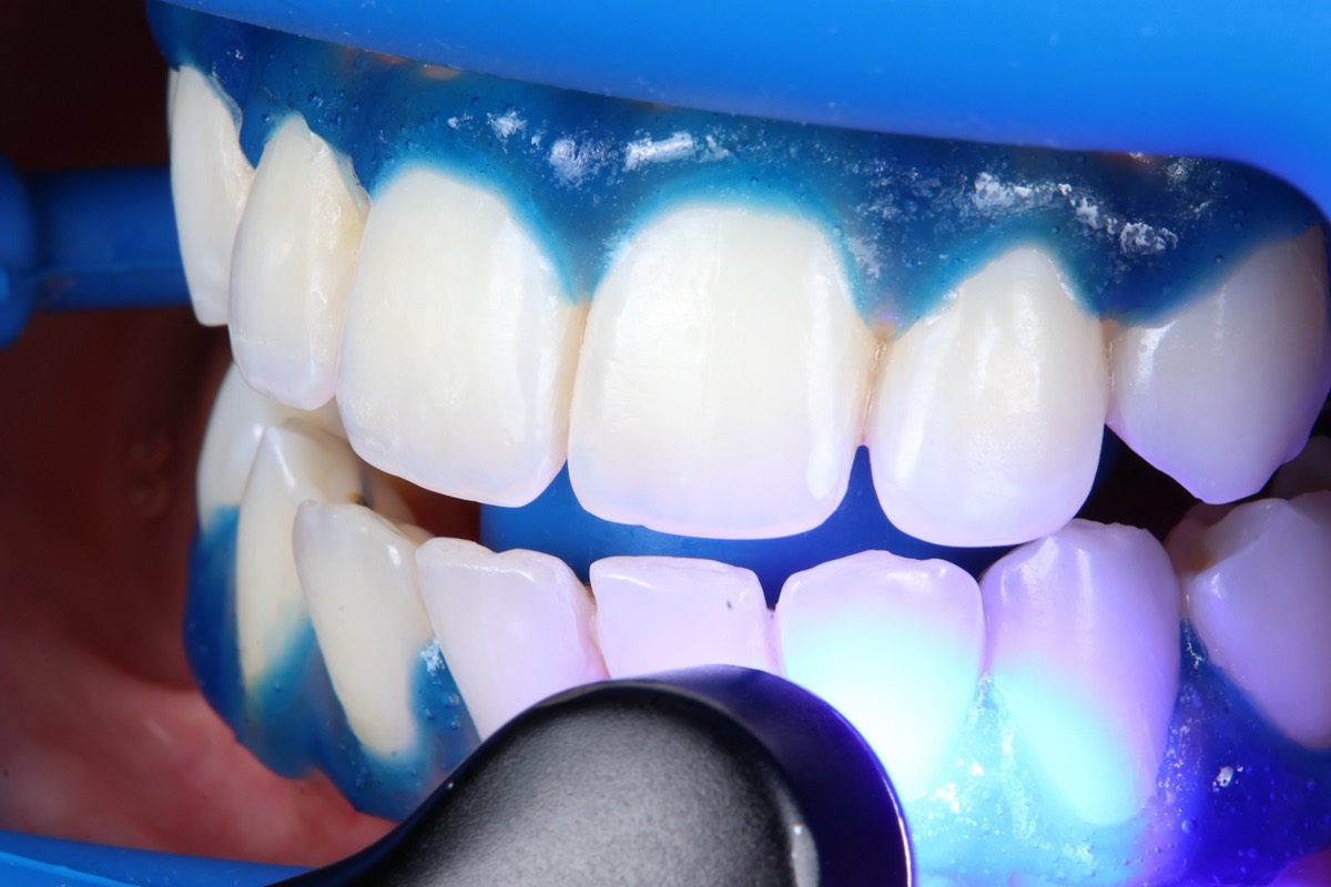 Smile Case 2 image 12