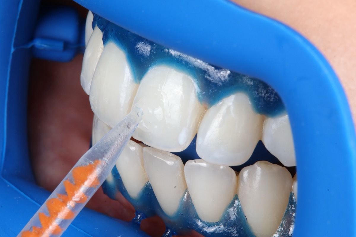 Smile Case 2 image 15