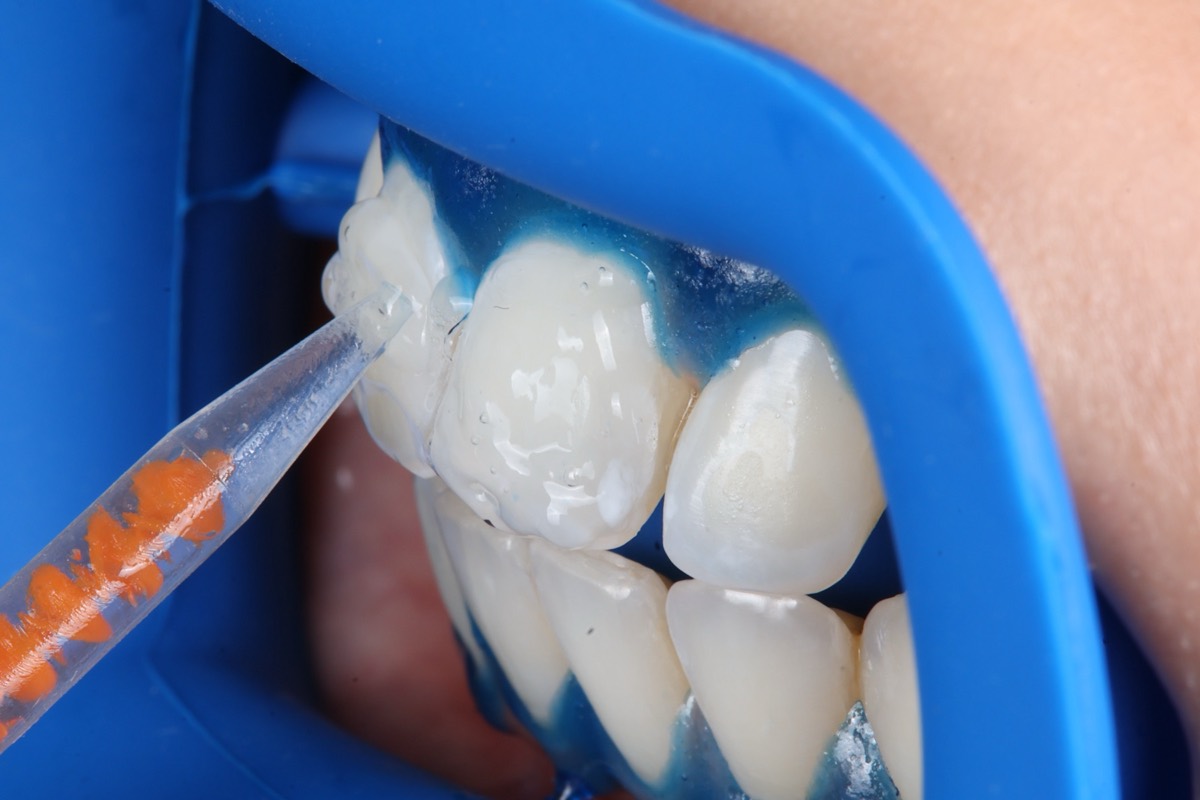 Smile Case 2 image 16