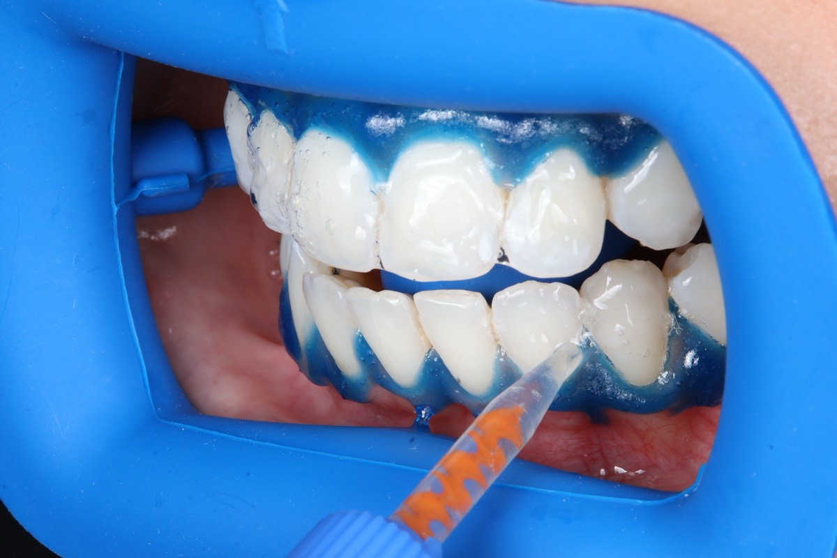 Smile Case 2 image 17