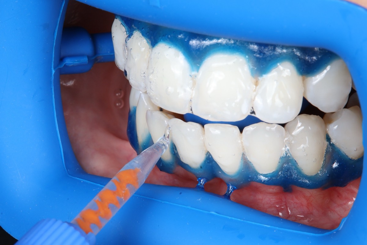 Smile Case 2 image 19