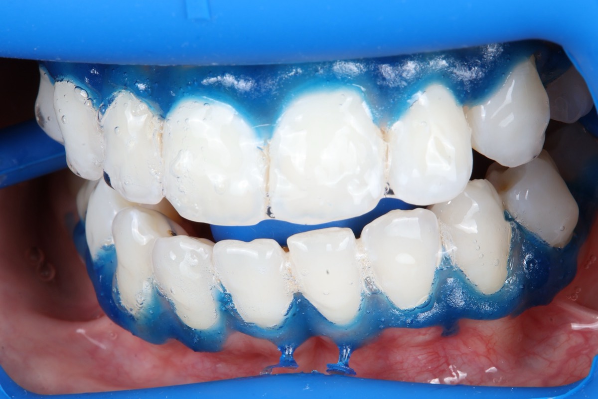 Smile Case 2 image 20