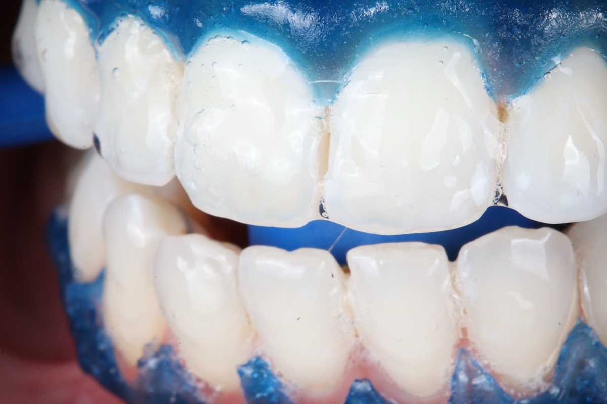 Smile Case 2 image 23