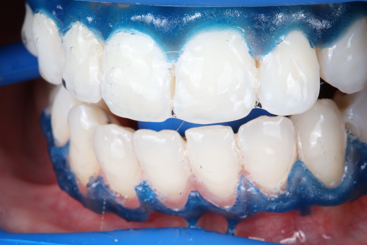 Smile Case 2 image 24