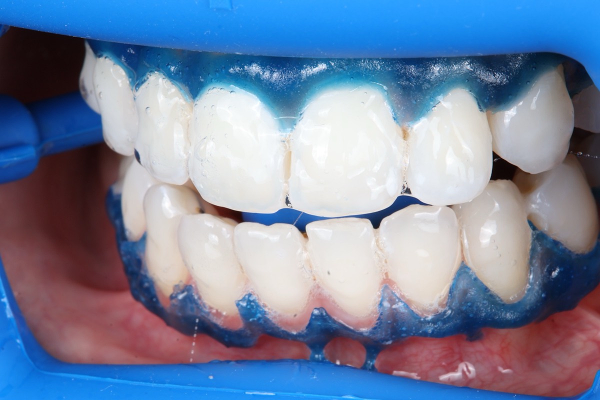 Smile Case 2 image 25