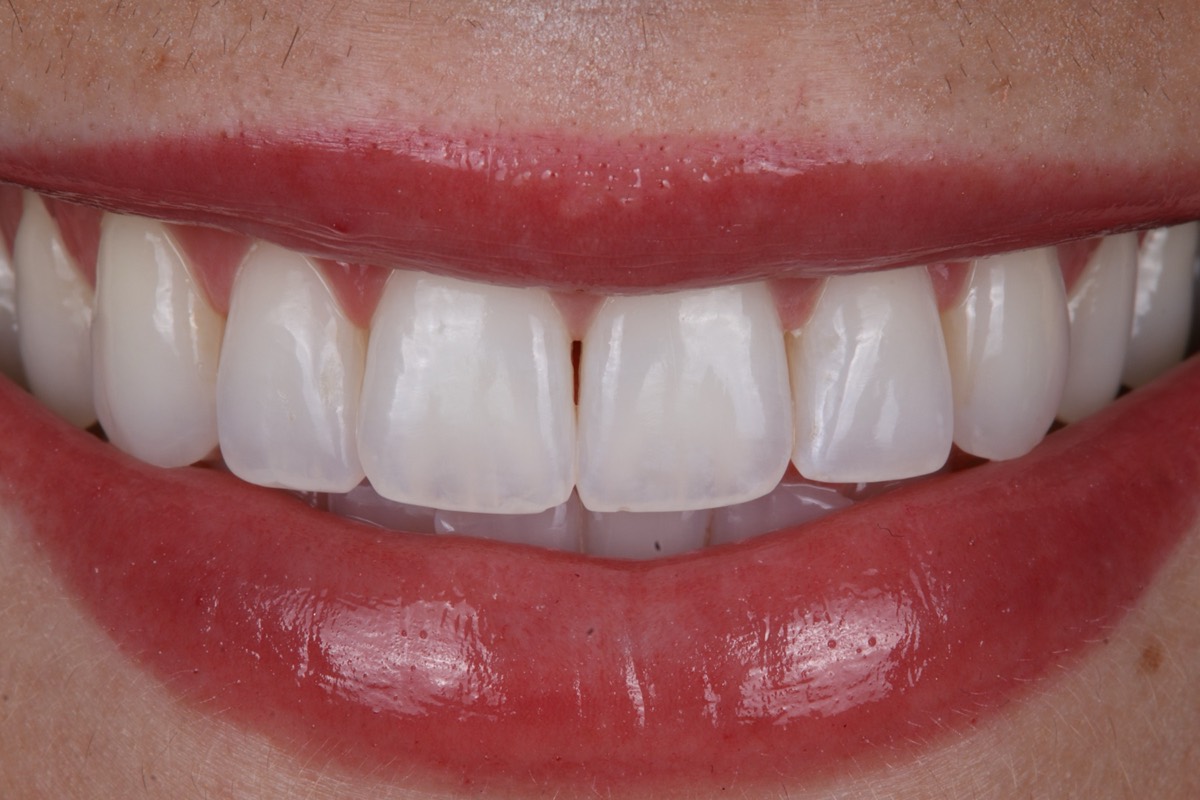 Smile Case 3 image 11
