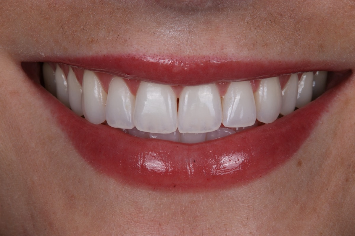 Smile Case 3 image 12