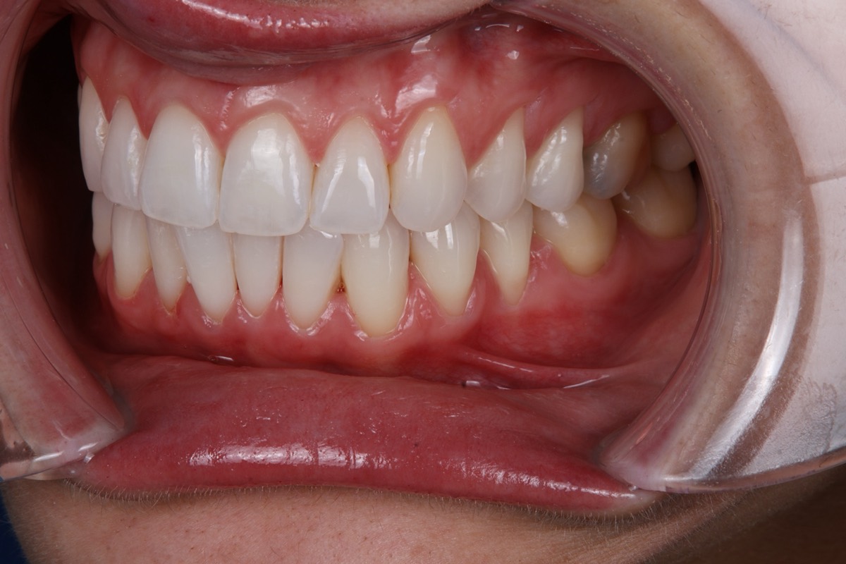 Smile Case 3 image 13