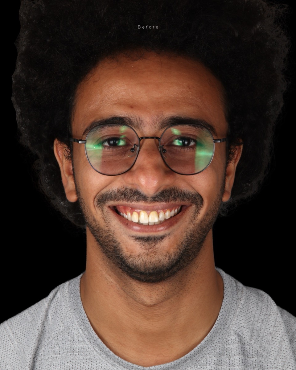 Smile Case 4 image 2