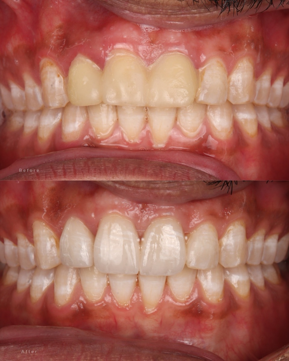 Smile Case 4 image 3