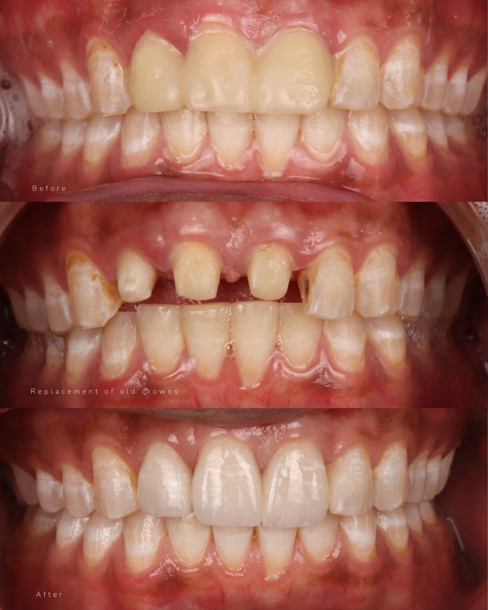 Smile Case 4 image 4