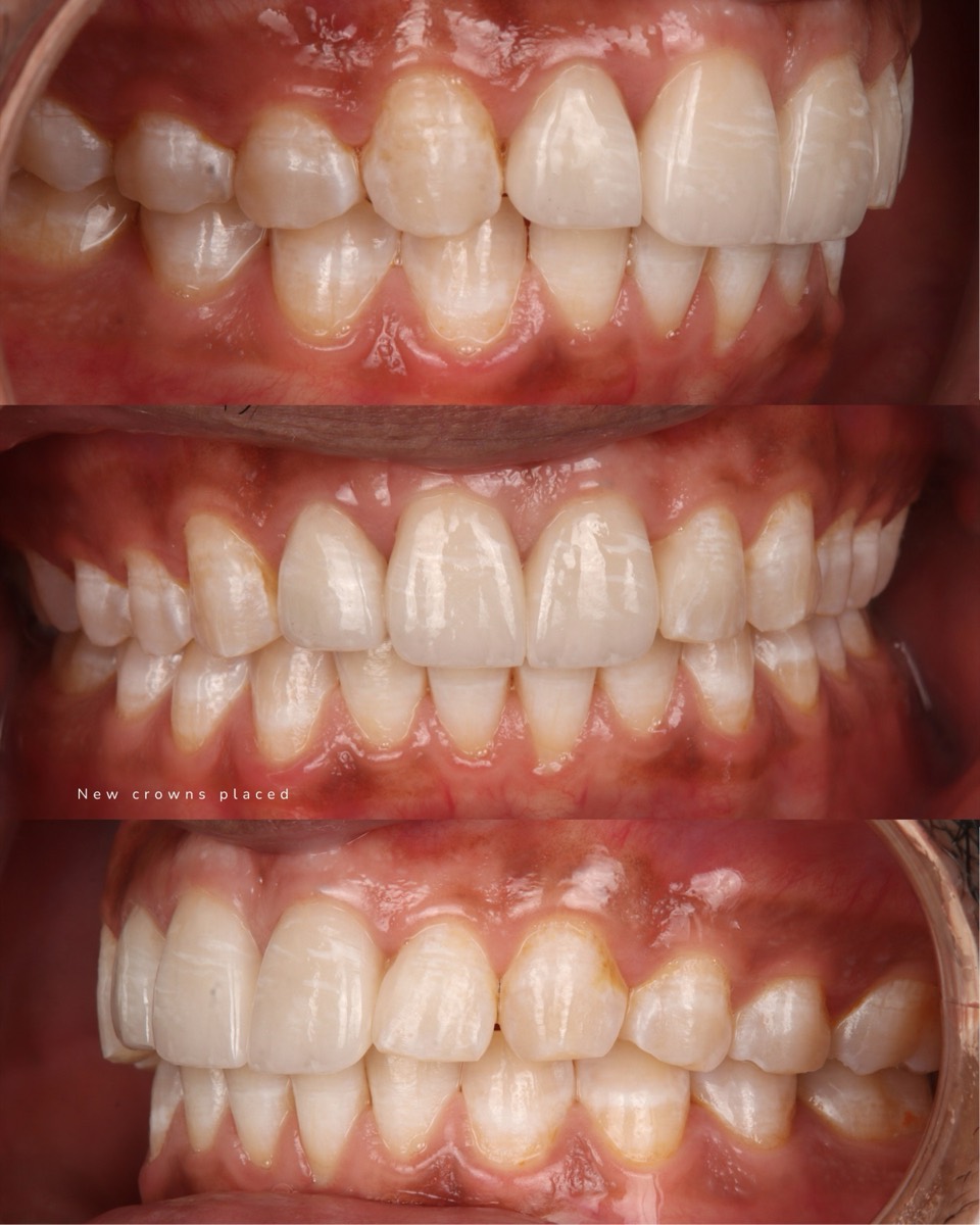 Smile Case 4 image 5