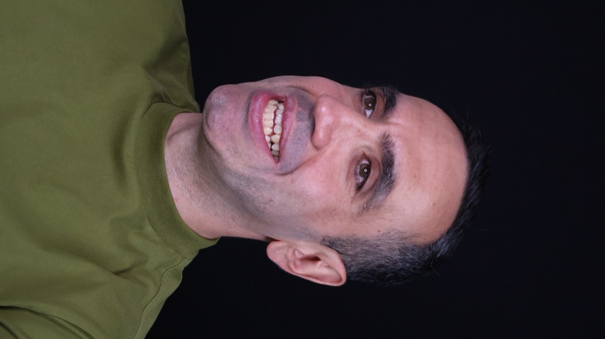 Smile Case 8 image 4