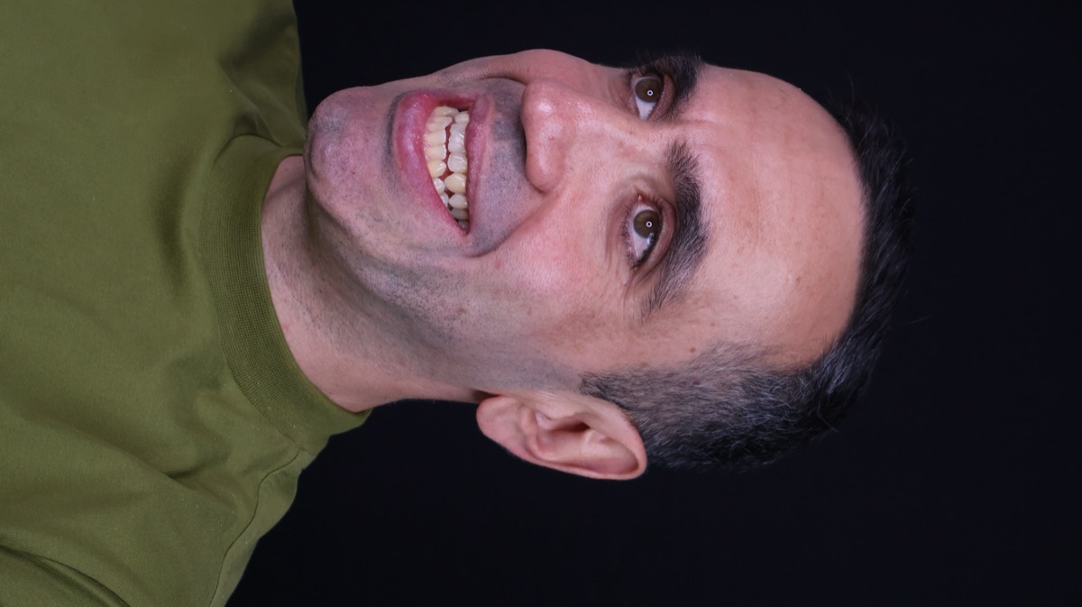 Smile Case 8 image 6