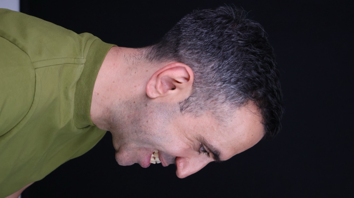 Smile Case 8 image 13