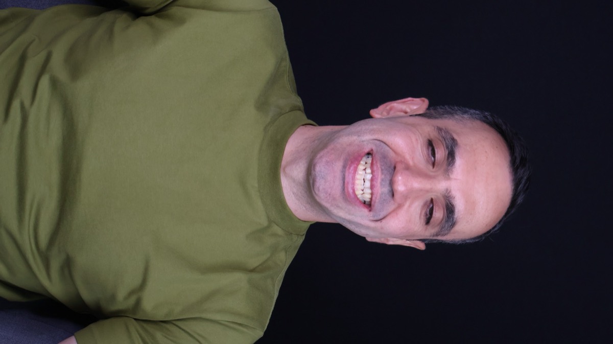 Smile Case 8 image 15